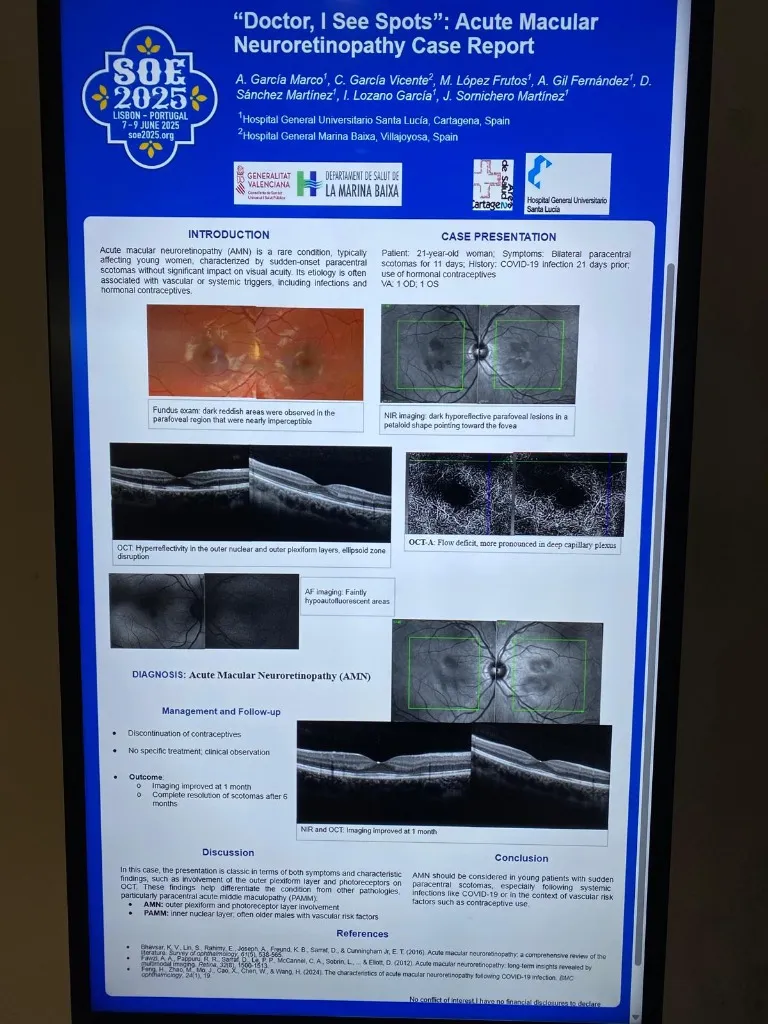 Póster presentado en el congreso SOE 2025: Acute Macular Neuroretinopathy