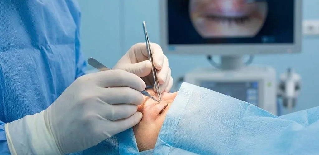 Blefaroplastias